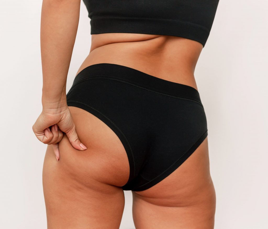 Photo of a woman pinching her butt