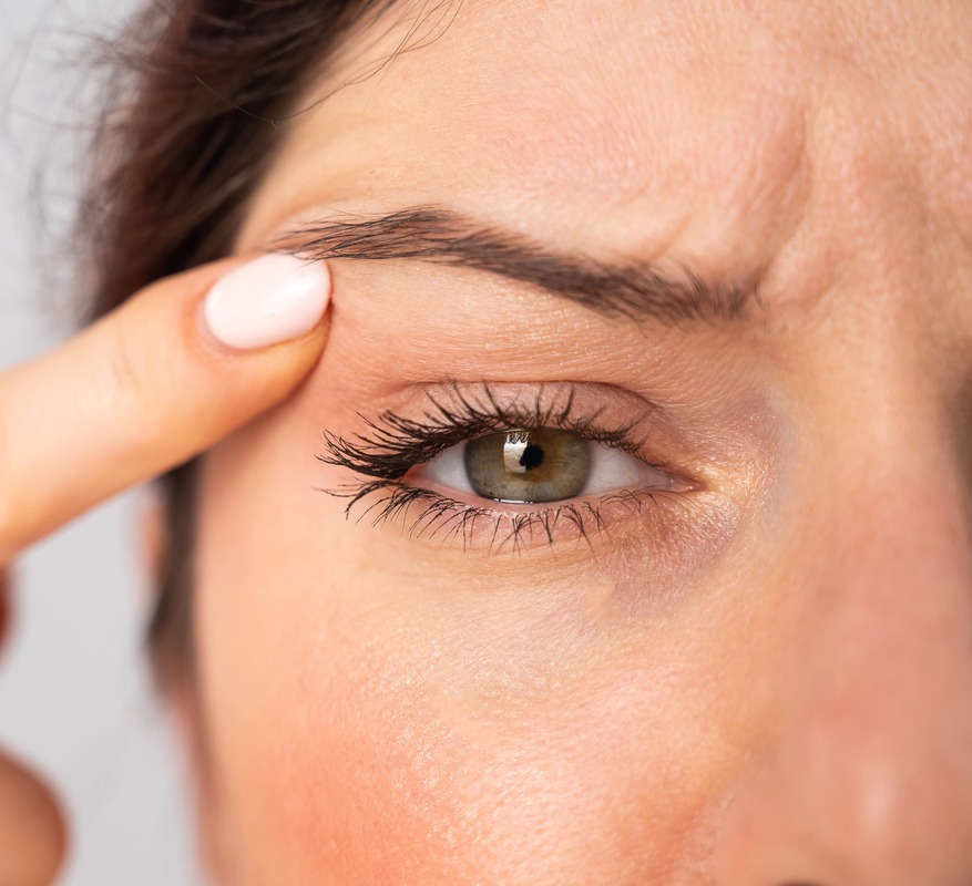 Photo of a woman pushing up the skin above her eyelid