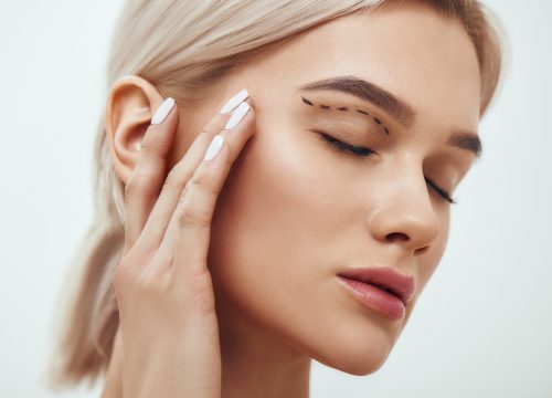 Photo of a woman being prepped for eyelid surgery
