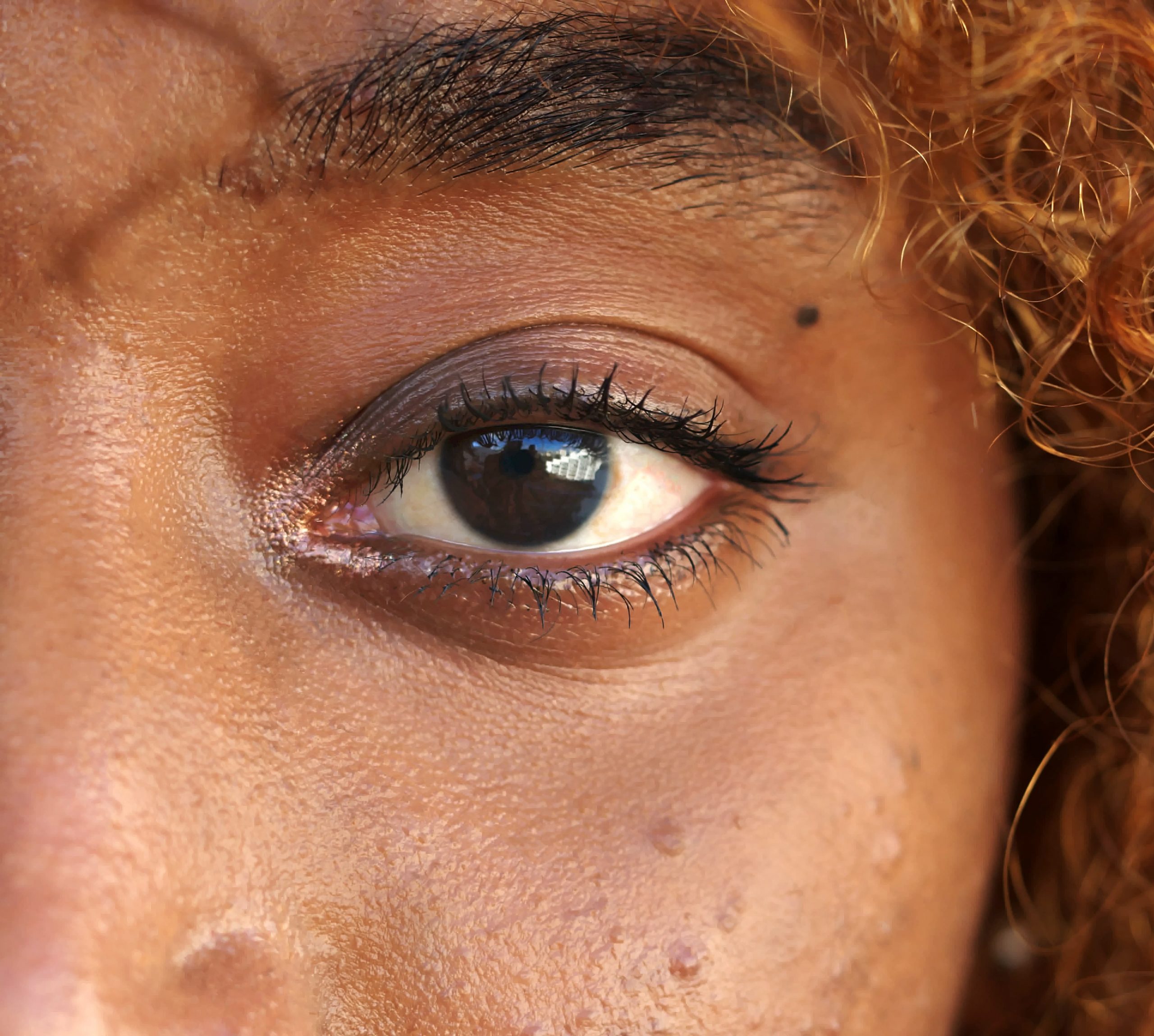 Photo of a woman's eye and eyelid
