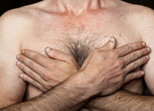 Photo of a man covering his breasts with his hands