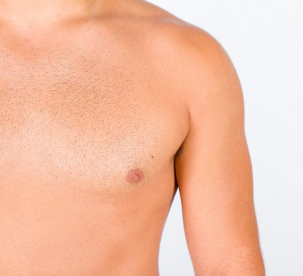 Photo of a man's flat chest