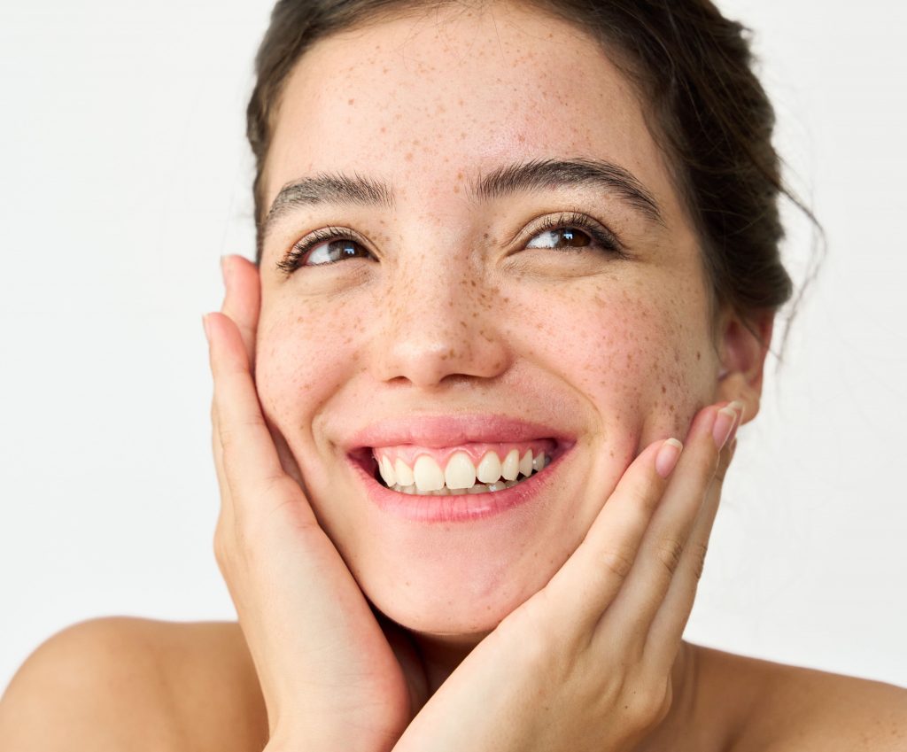 Photo of a woman with pigmentation and freckles on her face