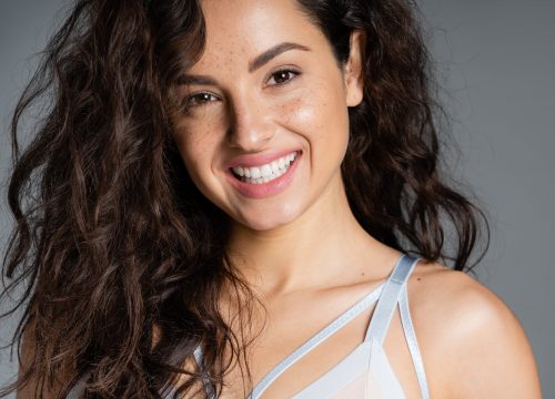 Photo of a woman with great skin after IPL photofacial treatments