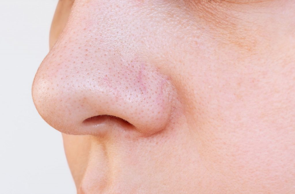 Photo of a woman's nose