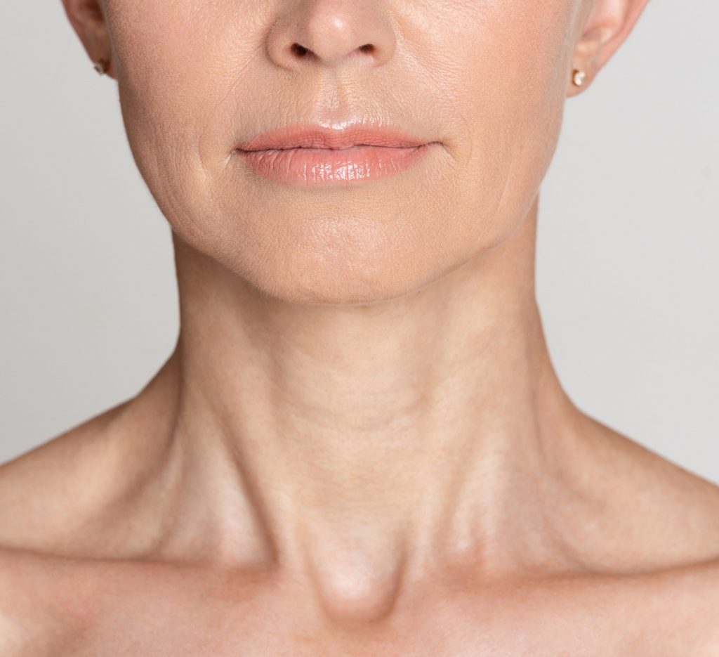 Photo of a middle-age woman's neck