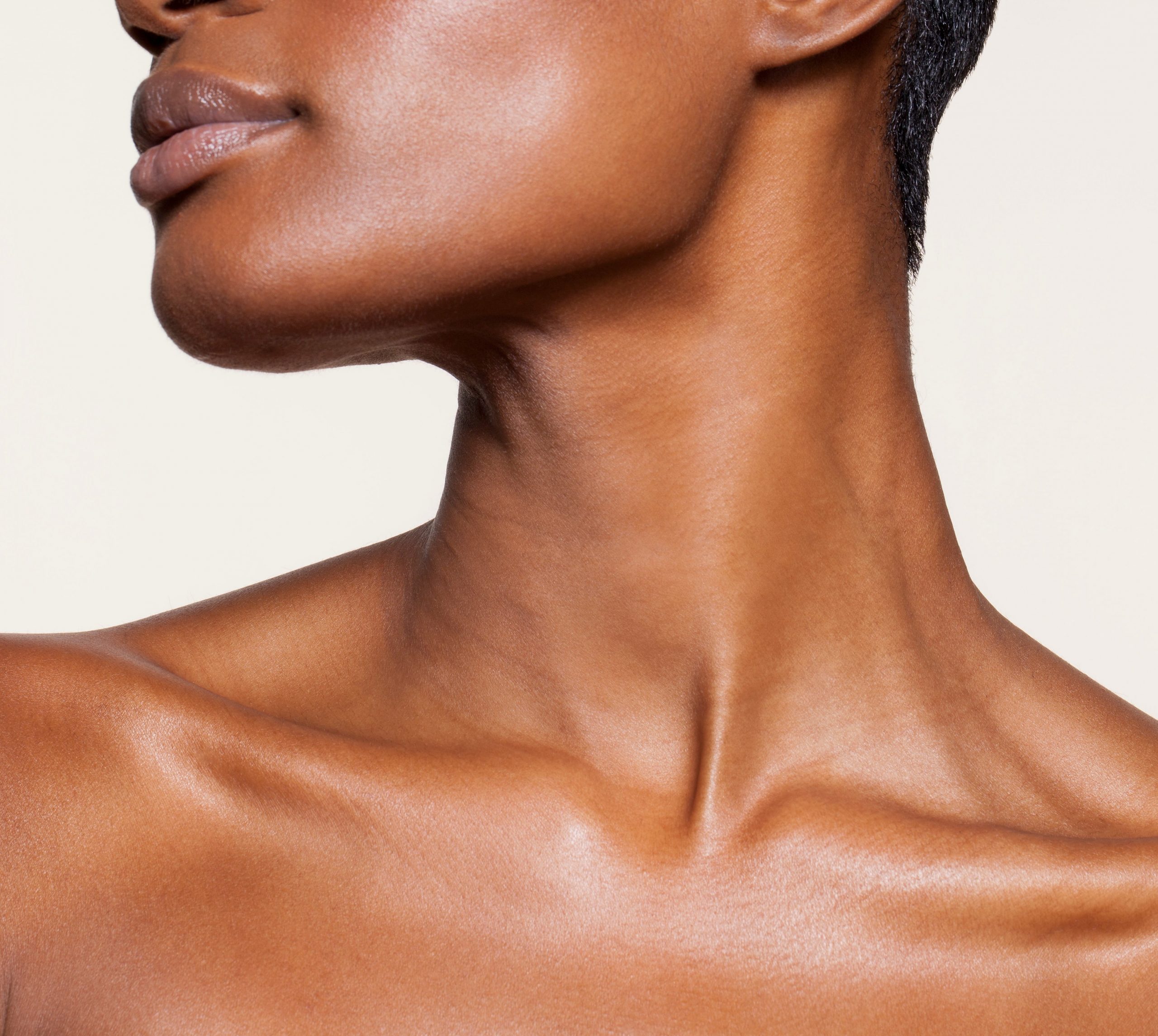 Neck Lift