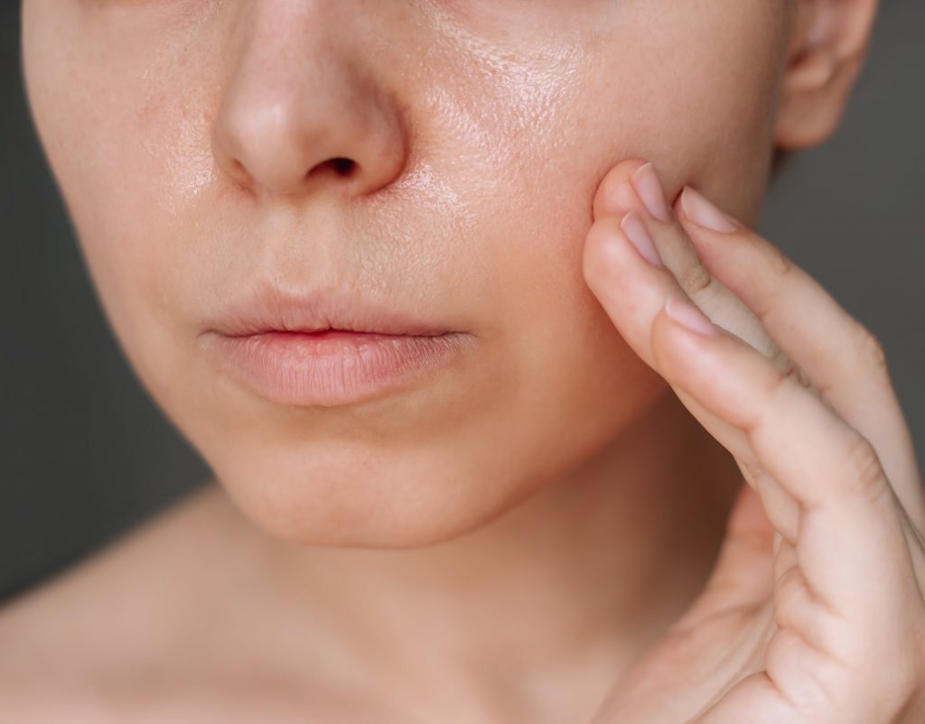 Photo of a woman touching her left cheek