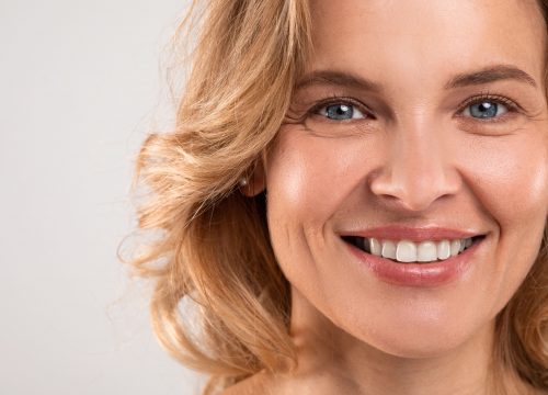 Photo of a middle-aged woman with great skin after Venus Freeze™ anti-aging treatments