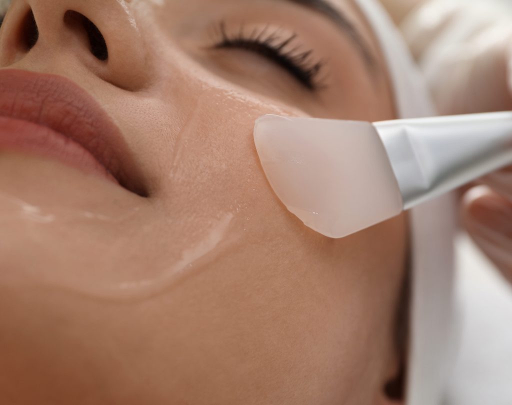 Photo of a woman getting a Vi Peel