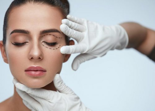 Photo of a woman getting eyelid surgery