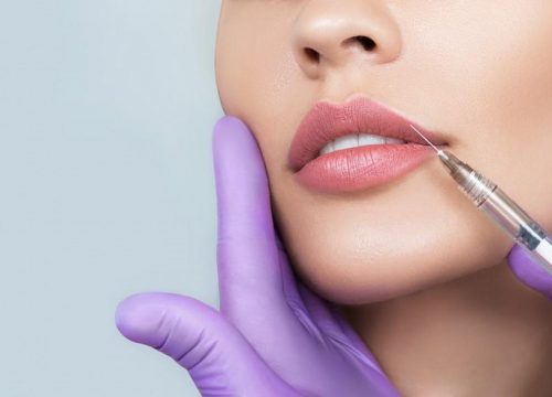 Photo of a woman getting lip fillers