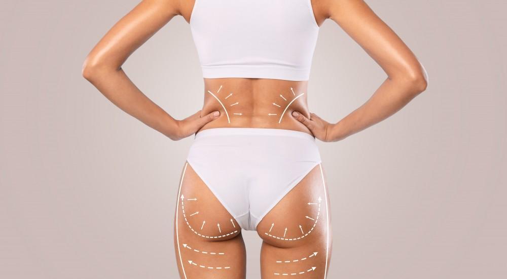 Brazilian Butt Lift: Your Complete Guide to an Optimal Recovery