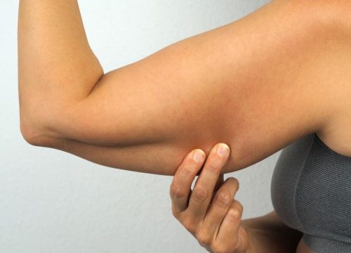 Photo of a woman pulling on the loose skin on her arm