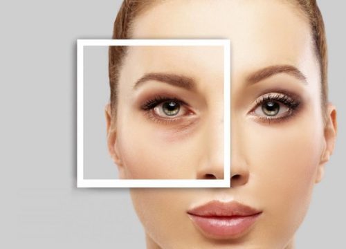 Photo that has a close-up of a woman's right eye