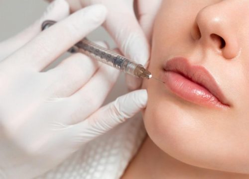 Photo of a woman getting lip injections