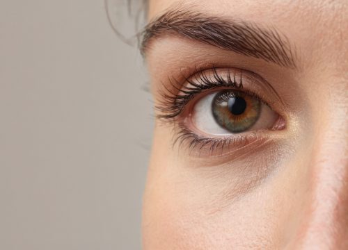 Photo of a woman's brown eye and under-eye area after Ariessence™ PDGF Under-Eye Rejuvenation